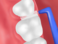 デンタルフロスを使って、歯の隙間の汚れもきれいに落とします。